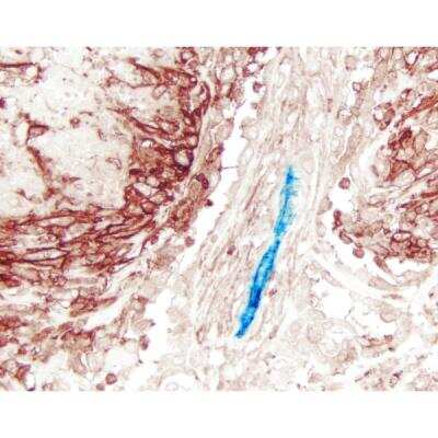 Immunohistochemistry: VECTASTAIN(R) ELITE(R) ABC anti-mouse/rabbit HRP Immunodetection Kit [PK-6200-NB]