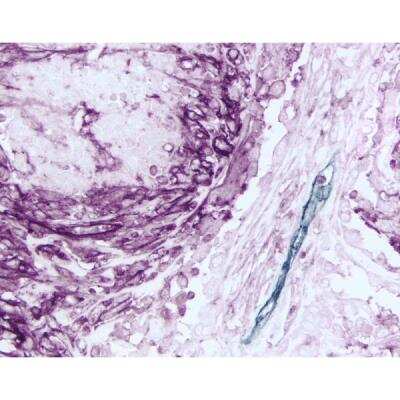 Immunohistochemistry: VECTASTAIN(R) ELITE(R) ABC anti-mouse/rabbit HRP Immunodetection Kit [PK-6200-NB]