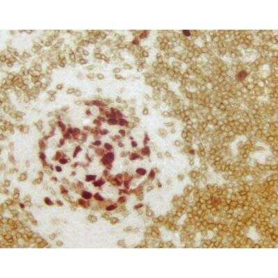 Immunohistochemistry: VECTASTAIN(R) ELITE(R) ABC anti-mouse/rabbit HRP Immunodetection Kit [PK-6200-NB]