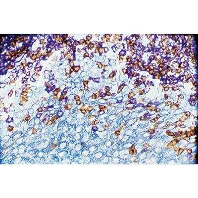 Immunohistochemistry: VECTASTAIN(R) ELITE(R) ABC anti-mouse/rabbit HRP Immunodetection Kit [PK-6200-NB]