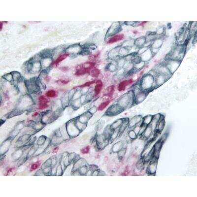 Immunohistochemistry: VECTASTAIN(R) ELITE(R) ABC anti-mouse/rabbit HRP Immunodetection Kit [PK-6200-NB]