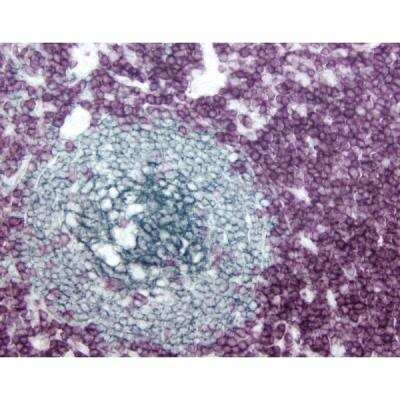 Immunohistochemistry: VECTASTAIN(R) ELITE(R) ABC anti-mouse/rabbit HRP Immunodetection Kit [PK-6200-NB]