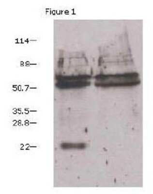Immunoprecipitation: VEGF Antibody (6B7) - BSA Free [NBP1-19181]