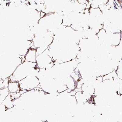 Immunohistochemistry-Paraffin: VEGF Antibody [NBP2-76563]