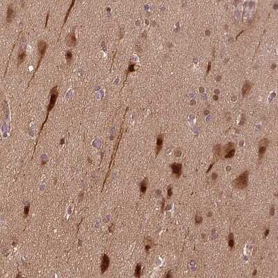 Immunohistochemistry-Paraffin: VEGF Antibody [NBP2-76563]