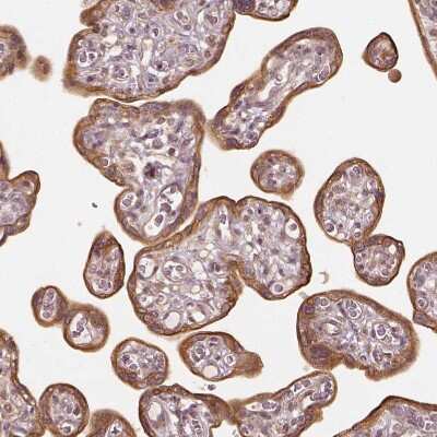 Immunohistochemistry-Paraffin: VEGF Antibody [NBP2-76563]