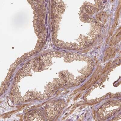 Immunohistochemistry-Paraffin: VEGF Antibody [NBP2-76563]