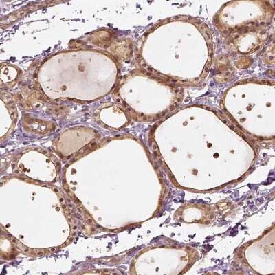 Immunohistochemistry-Paraffin: VEGF Antibody [NBP2-76563]