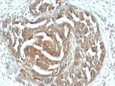 Immunohistochemistry-Paraffin: VEGF Antibody (VEGF/1063) [NBP2-45235]
