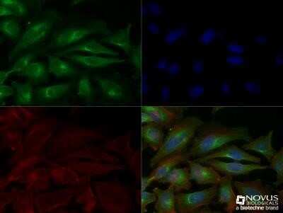 Immunocytochemistry/Immunofluorescence Staining of VEGF in HeLa Cells