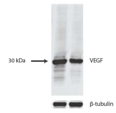 Western Blot Analysis of VEGF in Transfected Cell Lines
