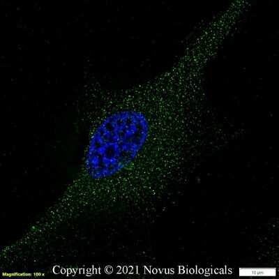 Immunocytochemistry/Immunofluorescence Staining of VEGF in U87 Cells