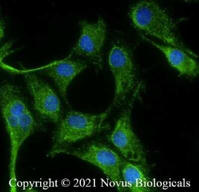 Immunocytochemistry/Immunofluorescence Staining of VEGF in U87 Cells