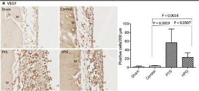 Immunohistochemical Analysis of VEGF in Peritoneal Tissue Sections