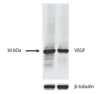 Western Blot Analysis of VEGF in Transfected Cell Lines