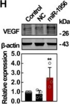 Western Blot Detection of VEGF in Transfected ADMSCs