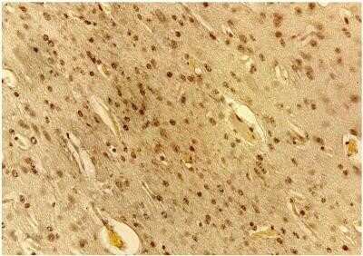 Immunohistochemistry: VEGF Antibody (VG76e) - Azide and BSA Free [NBP2-81006]