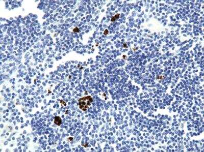 Immunohistochemistry-Paraffin: VEGF Antibody (VG76e) - BSA Free [NB100-648]