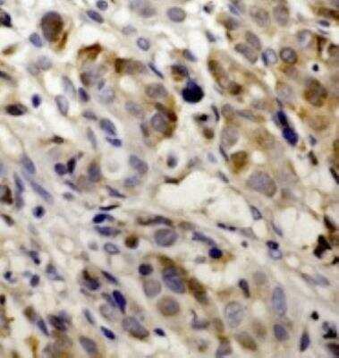 Immunohistochemistry-Paraffin: VEGF-C Antibody (107/F10) - Azide and BSA Free [NBP1-18626]