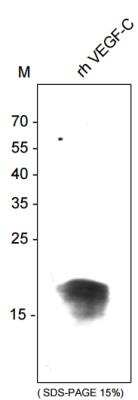 Western Blot: VEGF-C Antibody (107/F10)Azide and BSA Free [NBP1-18626]
