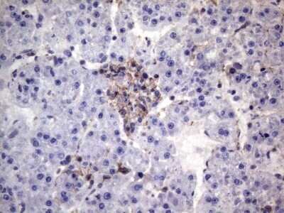 Immunohistochemistry: VEGF-C Antibody (OTI4A1) - Azide and BSA Free [NBP2-74845]