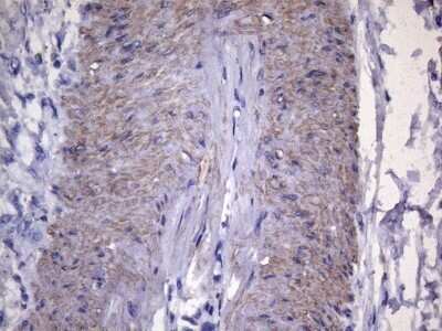 Immunohistochemistry: VEGF-C Antibody (OTI4A1) - Azide and BSA Free [NBP2-74845]