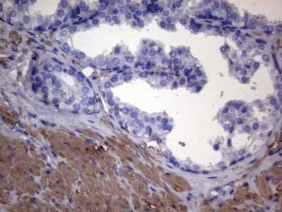 Immunohistochemistry: VEGF-C Antibody (OTI4A1) - Azide and BSA Free [NBP2-74845]