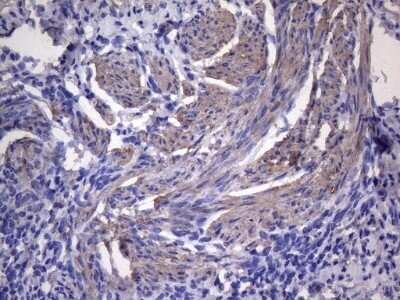Immunohistochemistry: VEGF-C Antibody (OTI4A1) - Azide and BSA Free [NBP2-74845]