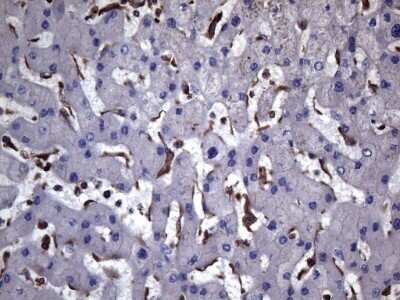 Immunohistochemistry: VEGF-C Antibody (OTI4A1) - Azide and BSA Free [NBP2-74845]