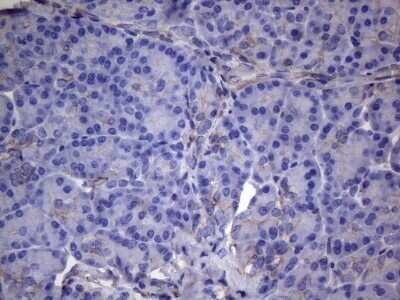 Immunohistochemistry: VEGF-C Antibody (OTI4A1) - Azide and BSA Free [NBP2-74845]