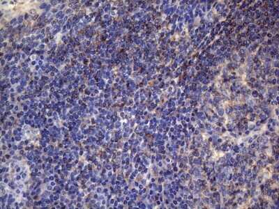 Immunohistochemistry: VEGF-C Antibody (OTI4A1) - Azide and BSA Free [NBP2-74845]