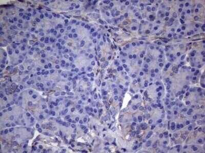 Immunohistochemistry-Paraffin: VEGF-C Antibody (OTI4A1) [NBP2-45404]