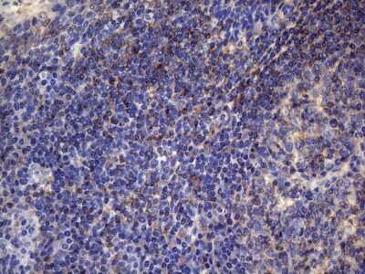 Immunohistochemistry-Paraffin: VEGF-C Antibody (OTI4A1) [NBP2-45404]
