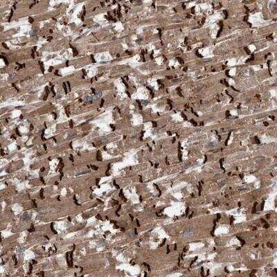 Immunohistochemistry-Paraffin: VEGF-D Antibody [NBP1-86865]