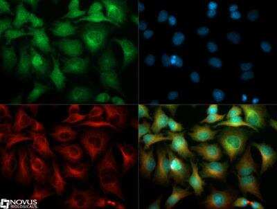 Immunocytochemistry/ Immunofluorescence: VEGFR1/Flt-1 Antibody [NB100-527]