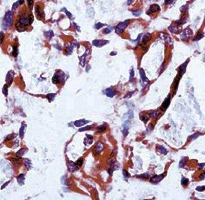 Immunohistochemistry: VEGFR1/Flt-1 Antibody [NB100-685]