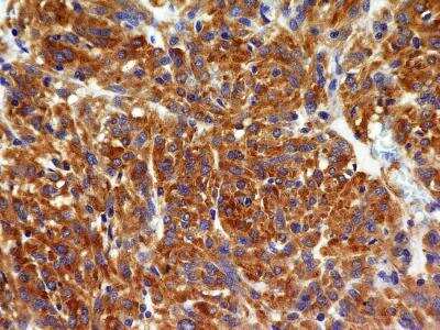 Immunohistochemistry-Paraffin: VEGFR2/KDR/Flk-1 Antibody (1B6) - BSA Free [NBP2-36428]