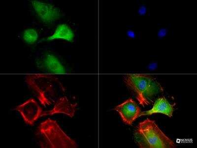 Immunocytochemistry/ Immunofluorescence: VEGFR2/KDR/Flk-1 Antibody (2C6) - BSA Free [NBP2-36429]