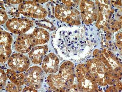 Immunohistochemistry-Paraffin: VEGFR2/KDR/Flk-1 Antibody (2C6) - BSA Free [NBP2-36429]