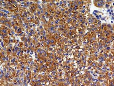 Immunohistochemistry-Paraffin: VEGFR2/KDR/Flk-1 Antibody (2C6) - BSA Free [NBP2-36429]