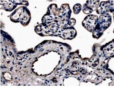 Immunohistochemistry-Paraffin: VEGFR3/Flt-4 Antibody (MM0003-7G63) - Azide and BSA Free [NB110-60968]