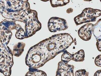 Immunohistochemistry-Paraffin: VEGF-D Antibody (MM0007-7E79) - Azide and BSA Free [NB110-60973]