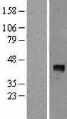Western Blot: VEGF-D Overexpression Lysate [NBL1-10722]