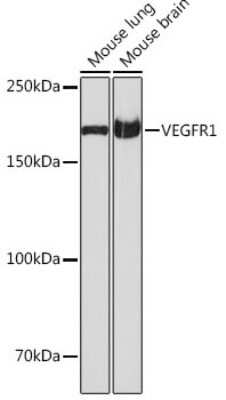 Western Blot: VEGFR1/Flt-1 Antibody (7F1A3) [NBP3-15683]