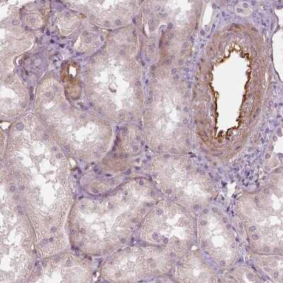 Immunohistochemistry-Paraffin: VEGFR1/Flt-1 Antibody (CL0344) [NBP2-52919]