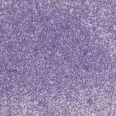 Immunohistochemistry-Paraffin: VEGFR1/Flt-1 Antibody (CL0344) [NBP2-52919]