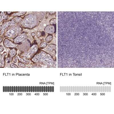Immunohistochemistry-Paraffin: VEGFR1/Flt-1 Antibody (CL0344) [NBP2-52919]