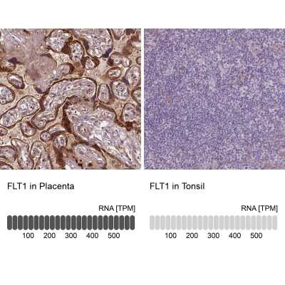 Immunohistochemistry-Paraffin: VEGFR1/Flt-1 Antibody (CL0345) [NBP2-30982]