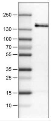 Western Blot: VEGFR1/Flt-1 Antibody (CL0345) [NBP2-30982]