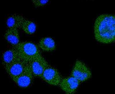 Immunocytochemistry/ Immunofluorescence: VEGFR1/Flt-1 Antibody (SY09-09) [NBP3-11864]